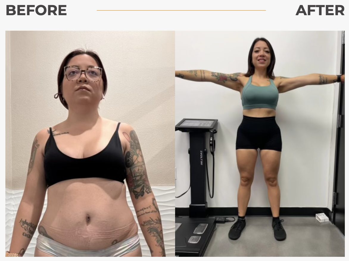 Revival patient before-and-after result 2