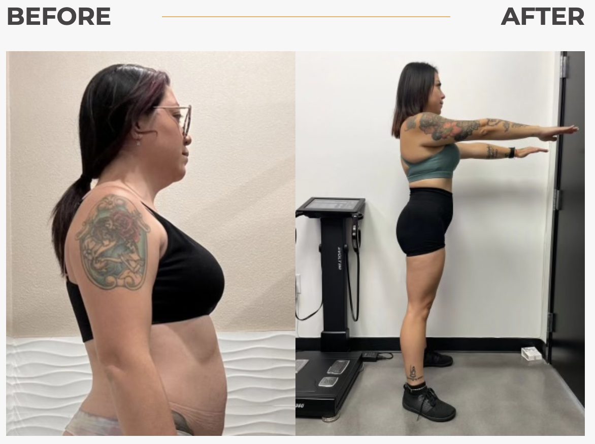 Revival patient before-and-after result 3