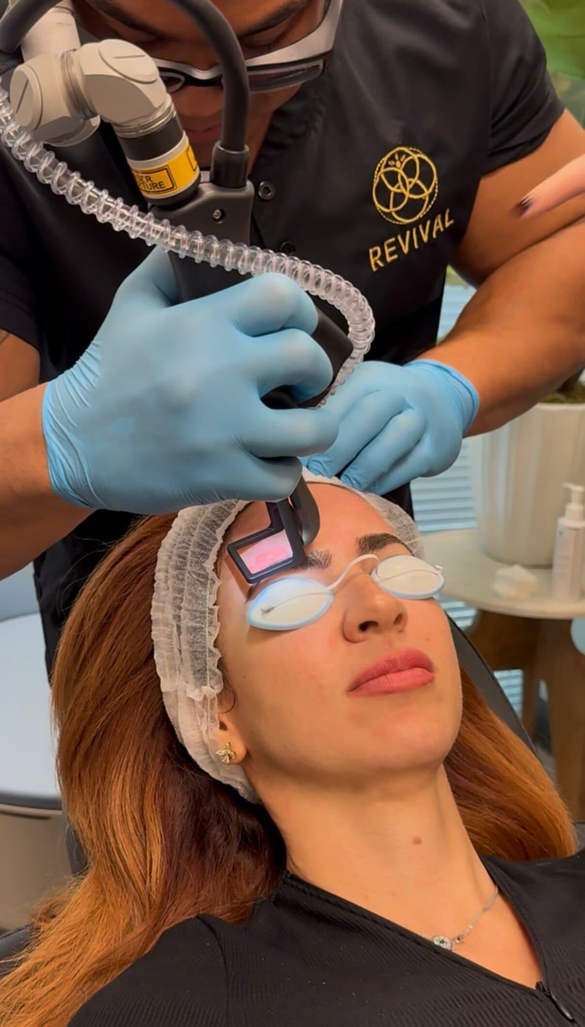 CoolPeel® CO₂ resurfacing treatment