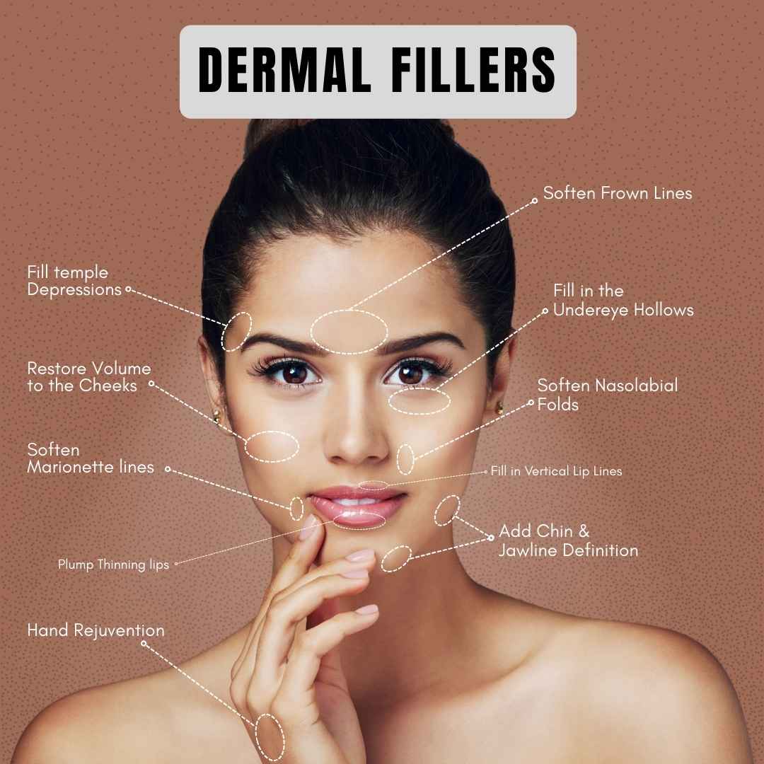 Dermal Filler for Overton, NV residents