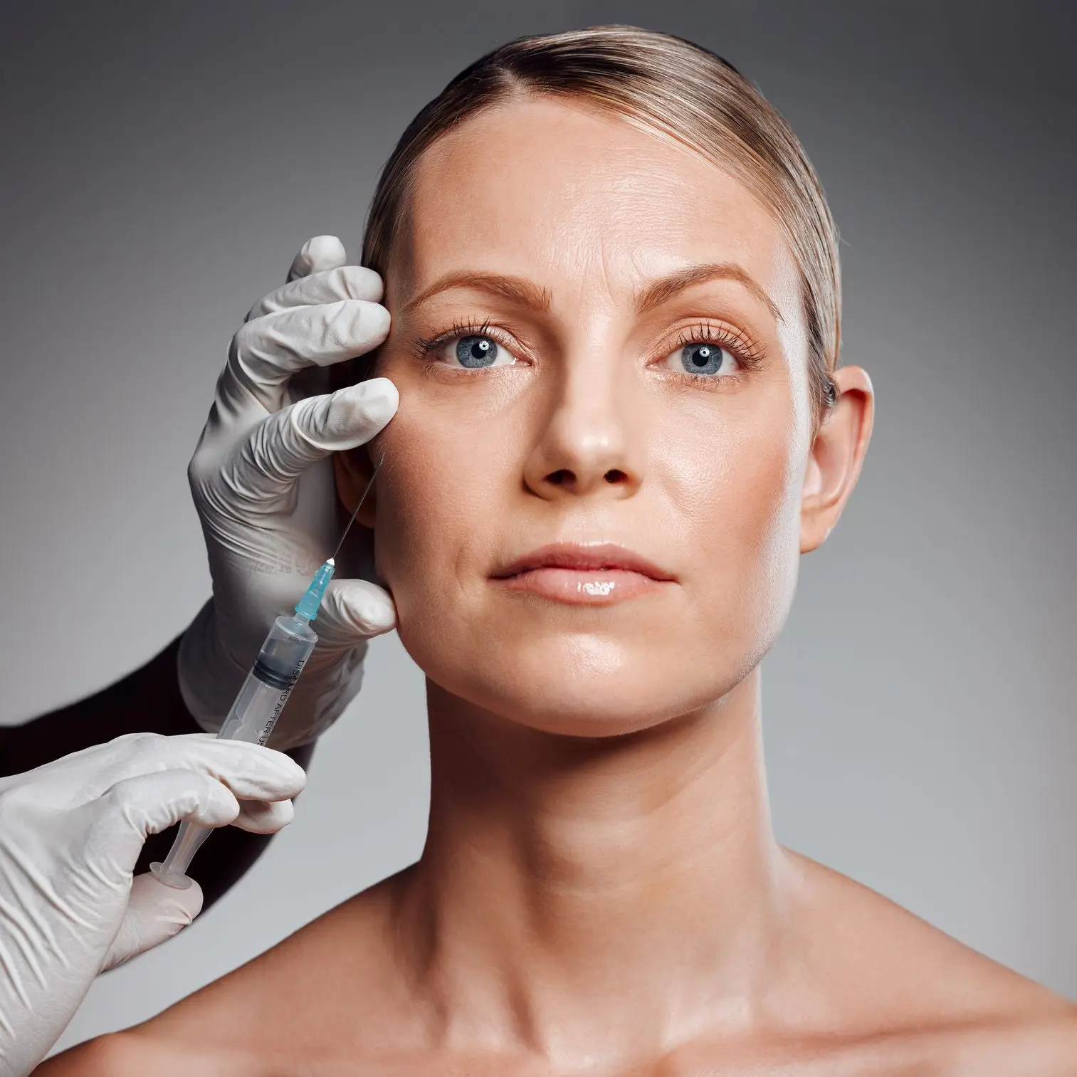 Dysport treatment target areas - face illustration