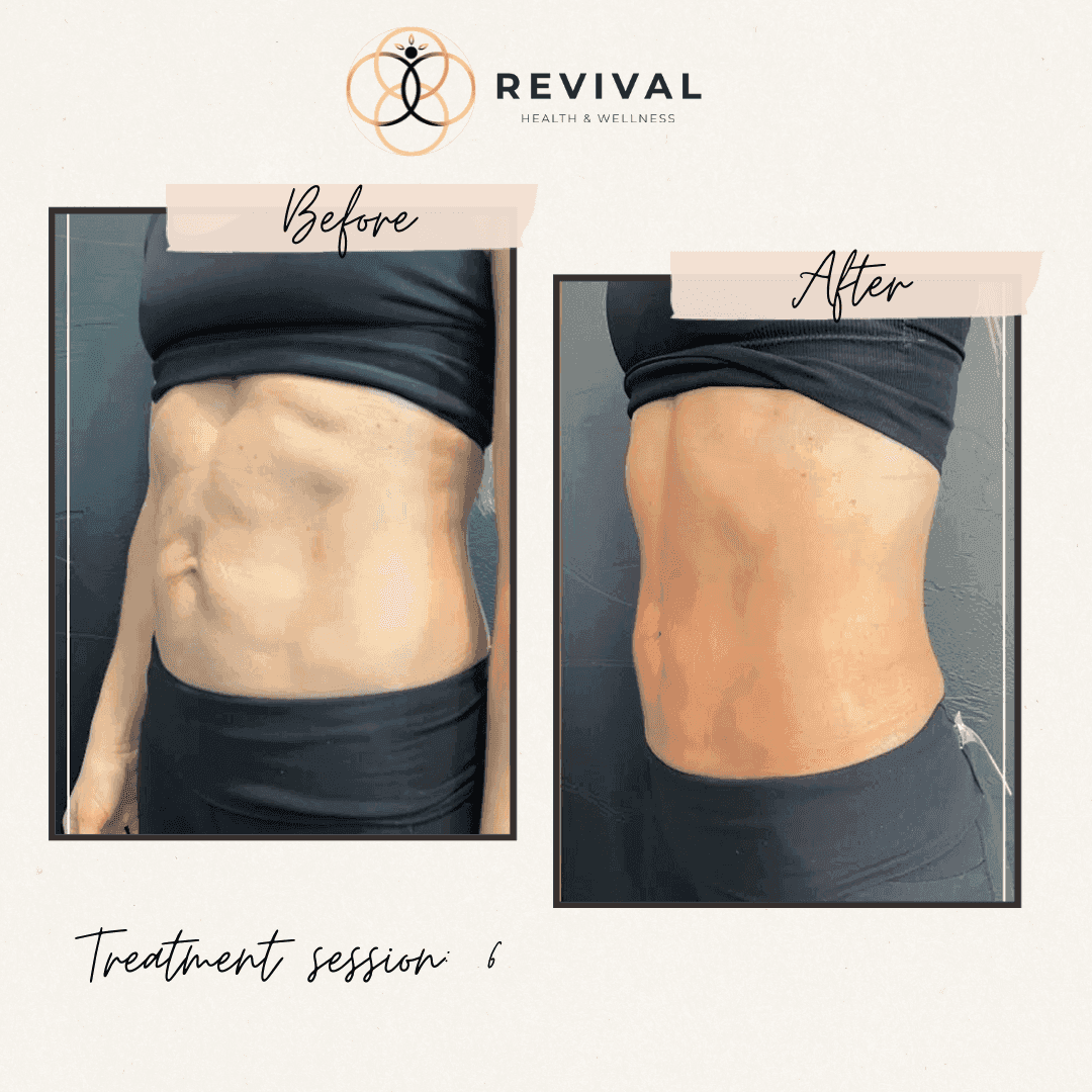 Revival patient before-and-after result 5