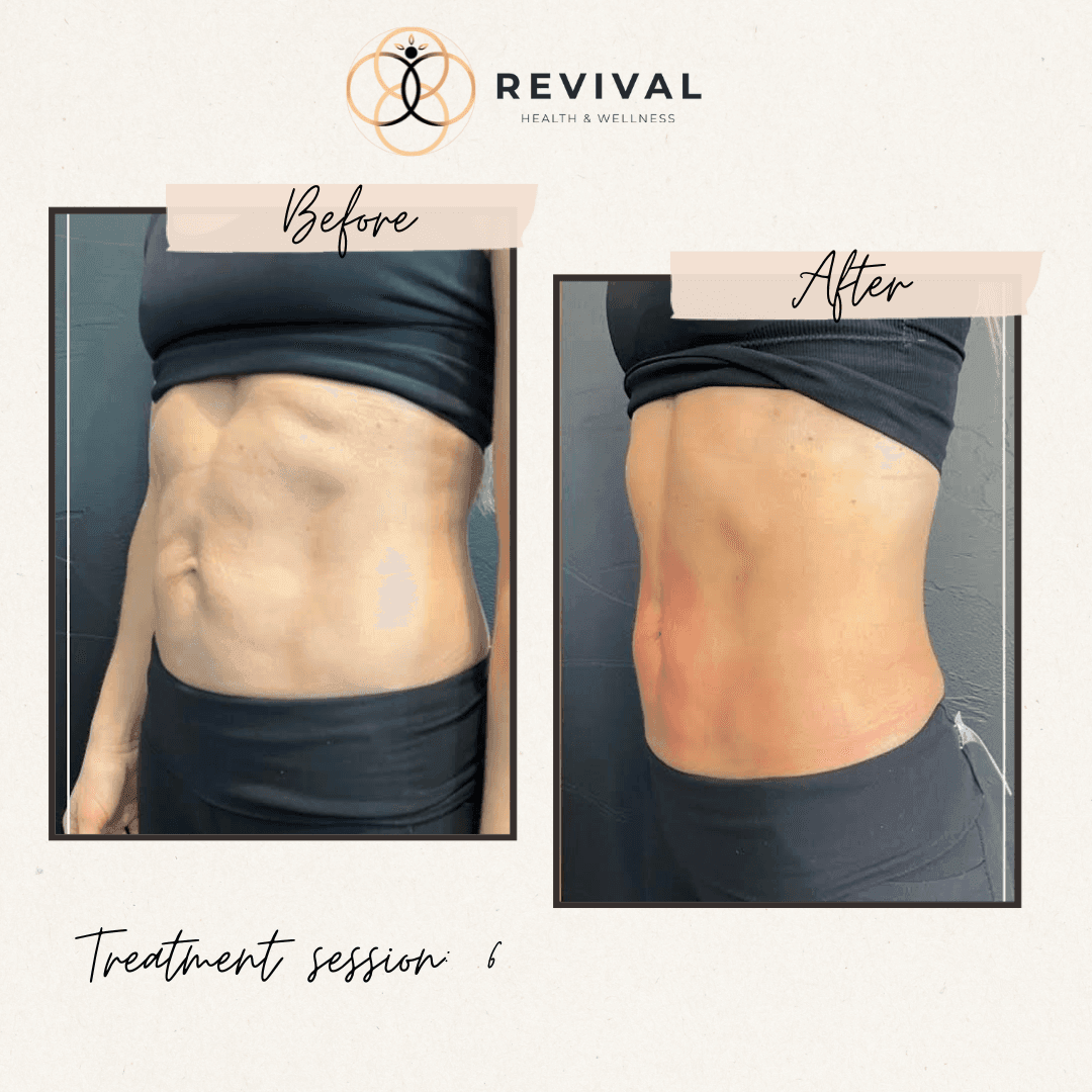 Revival patient before-and-after result 5