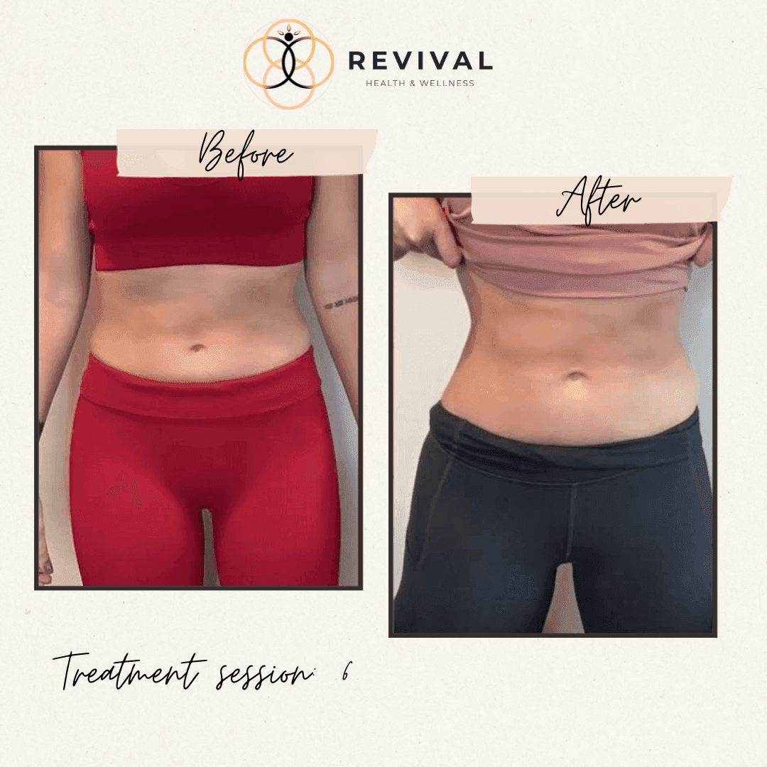 Revival patient before-and-after result 6