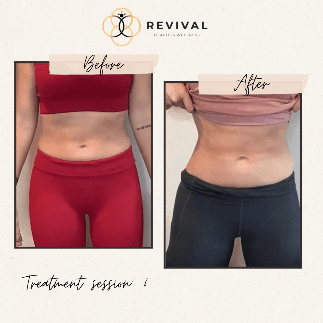 Revival patient before-and-after result 6