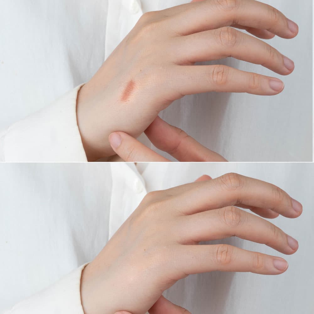 Scar camouflage before and after - hand