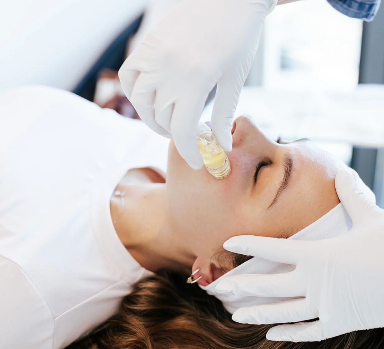 Microneedling at Revival Health & Wellness