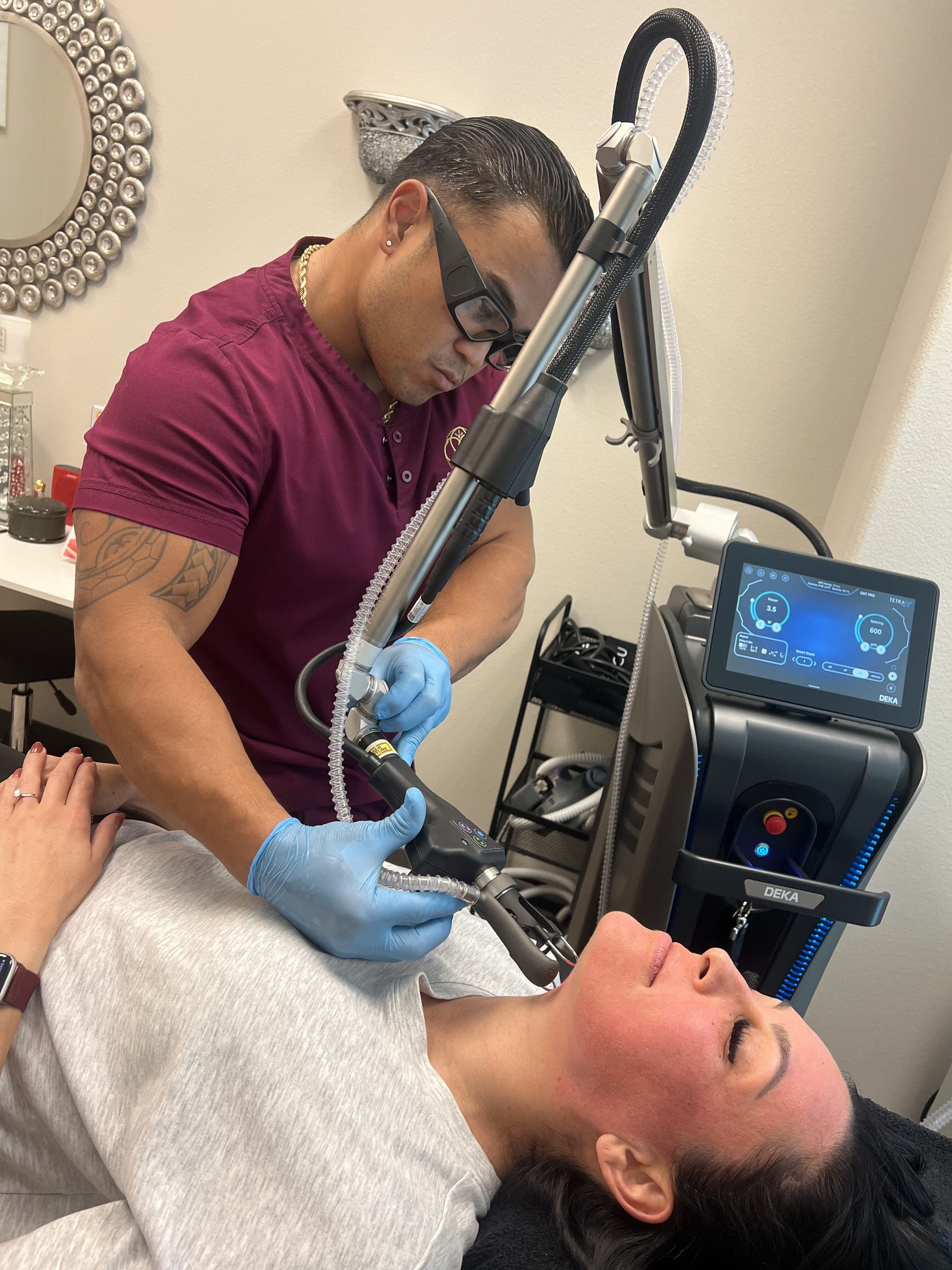 Deka Tetra Pro CO2 Laser for Overton, NV residents
