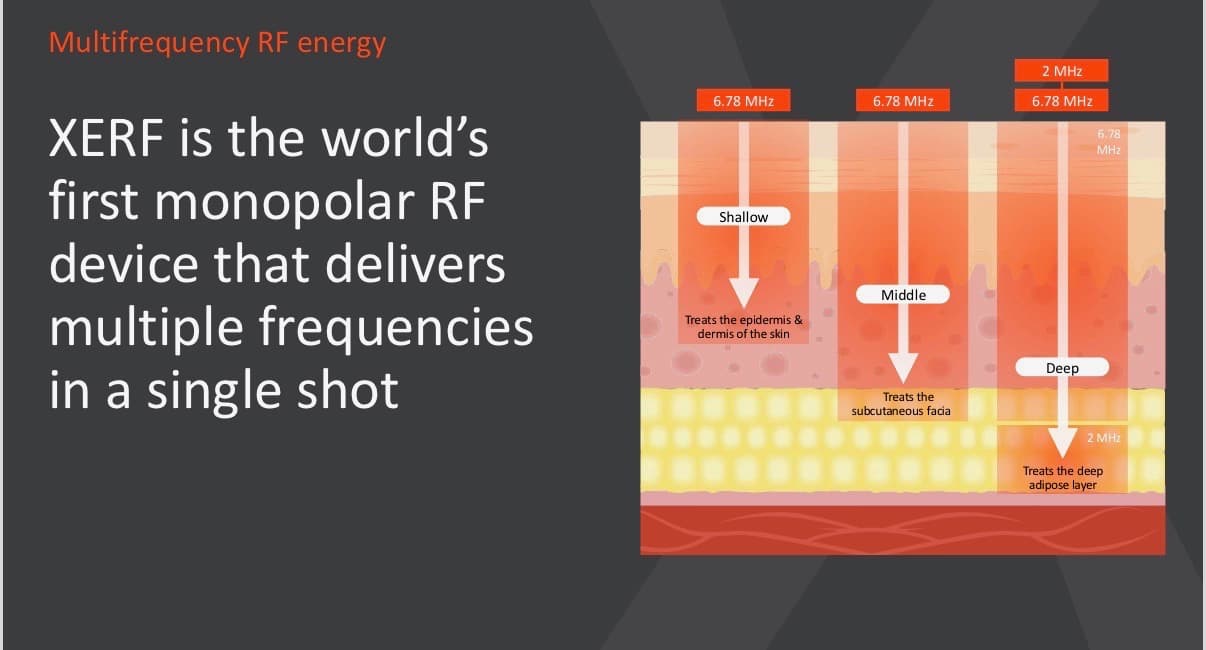 XERF monopolar RF technology diagram showing shallow, middle, and deep tissue penetration